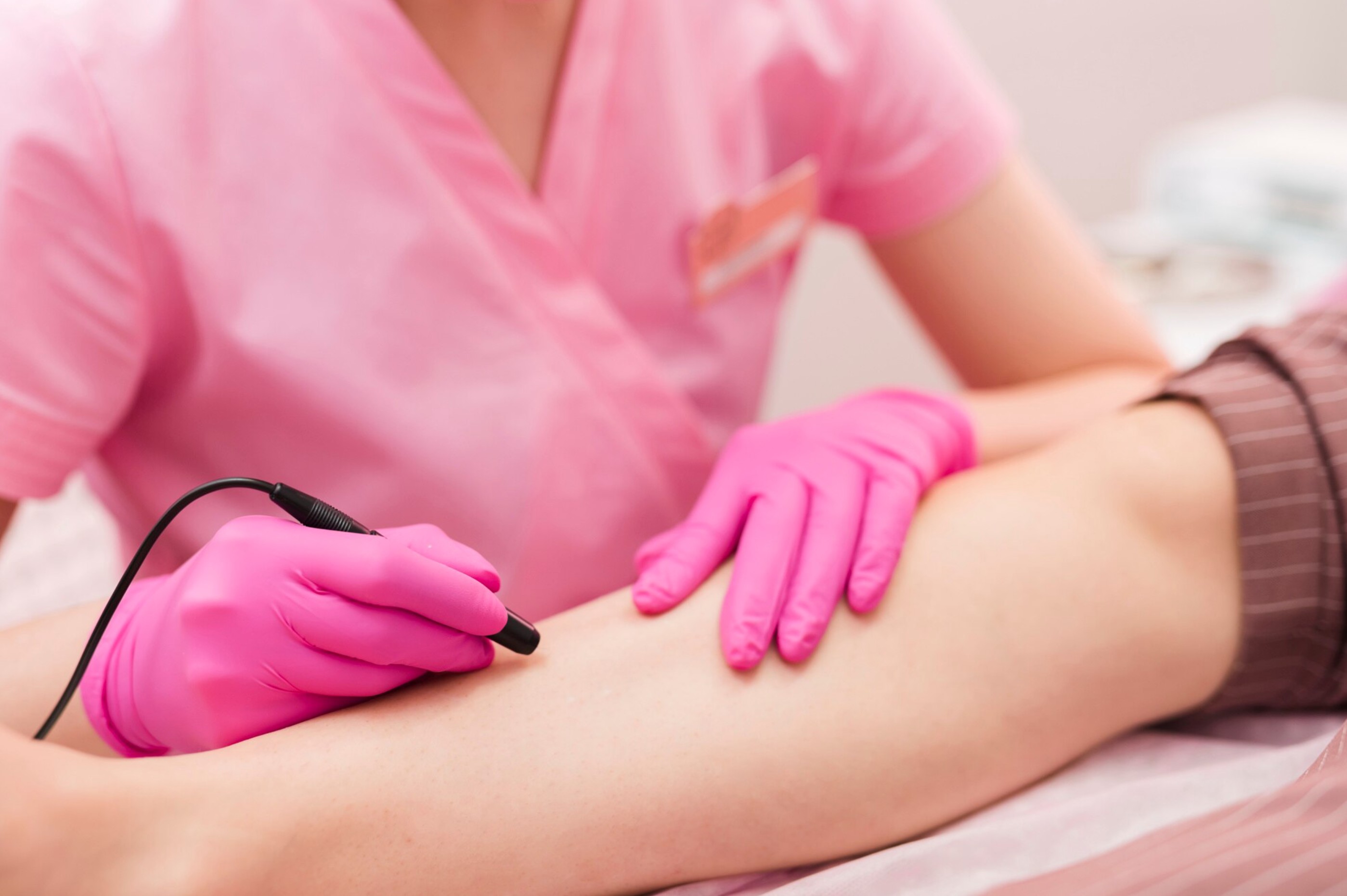 Hair Removal
