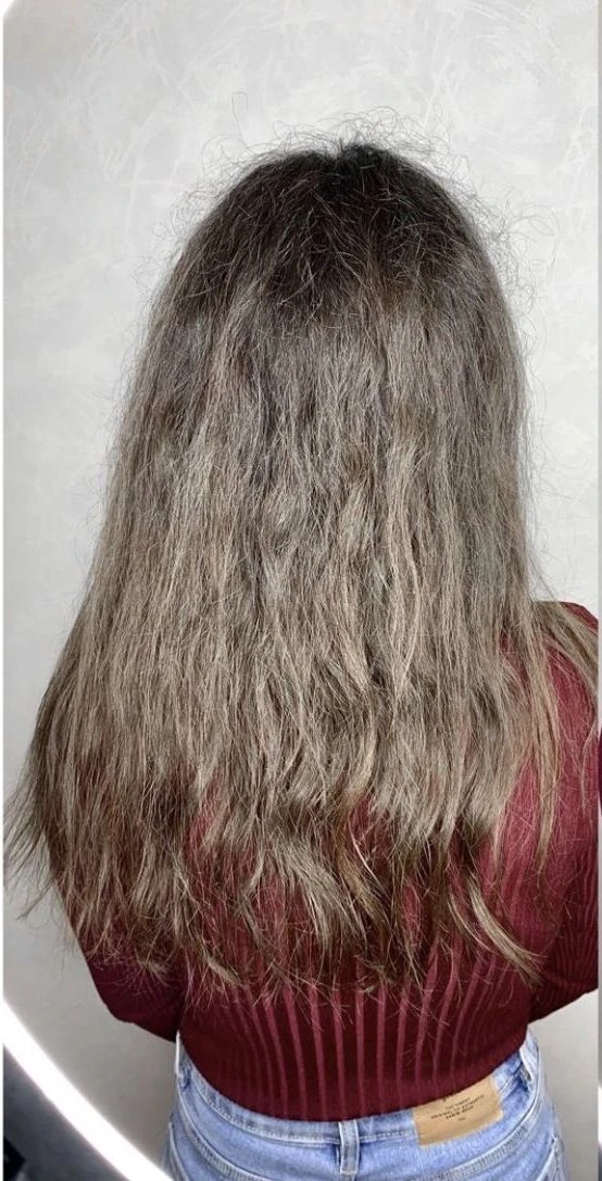 Before treatment result