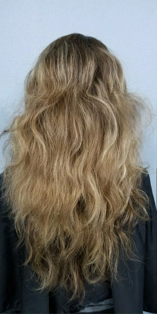 Before treatment result
